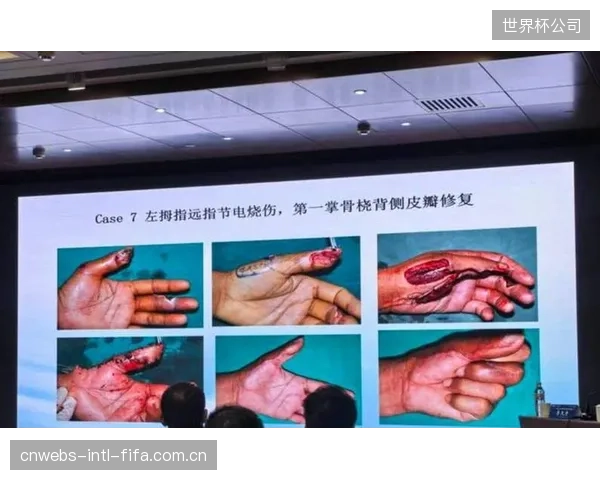 伤病潮促使各队更加重视科学训练与负荷管理,以求长期稳定。 伤病潮促使各队更加重视科学训练与负荷管理,以求长期稳定。